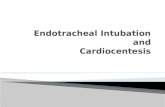 Endotracheal Intubation Ncm 106