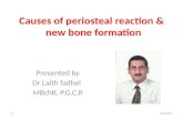 Dr.laith notes  about common causes of periosteal reaction