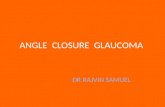 Angle  closure  glaucoma