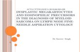 Dysplastic megakaryocytes and eosinophilic precursors in the diagnosis