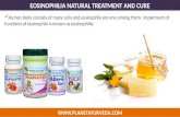 Eosinophilia natural treatment and cure