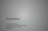 Papilledema - Dr Shylesh Dabke