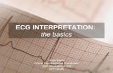 ECG interpretation: the basics