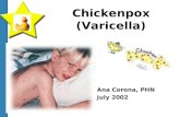 Chickenpox Presentation