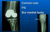 Briard Jl. How To Correct Extra Articular Deformity. Slide 41 56