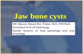 Jaw bone cyst