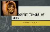 Malignant tumors of skin