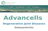Osteoarthritis Treatment | Stem Cell Treatment for Osteoarthritis