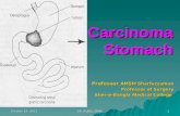 Carcinoma stomach sb-rubel