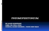 Ppp pneumoperitoneum