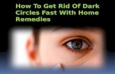 Top 5 Home Remedies to Get Rid Of Dark Circles Fast