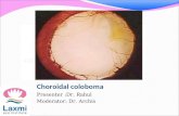 Choroidal coloboma