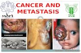 Cancer and metastasis