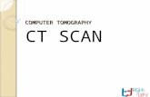 Computer Tomography (CT Scan)