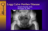 Legg calve perthes disease donnely 2001 5afad2fc5e0b007027c03a29b821eb3c