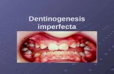 Dentinogenesis imperfecta