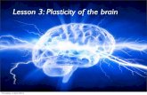 Lesson 3   plasticity rewiring of the brain 2013
