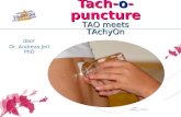 Tach-o-puncture door Dr. Andreas Jell PhD TAO meets TAchyOn.