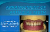 Arrangement of artificial teeth 1