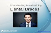 The Facts about Dental Braces