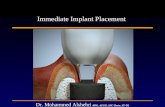 Immediate implant lecture
