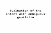 Evaluation of the infant with ambiguous genitalia