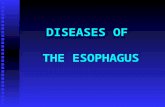 DISEASES OF THE ESOPHAGUS Approach to Esophageal Disease