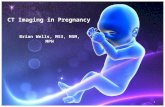 CT Imaging in Pregnancy