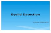 Biometric Security :Eyelid detection