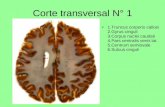 corte transversal de encefalo