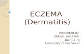 Eczema- A Chronic Skin Disease
