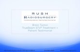 Rush Radiosurgery: Brain Metastases Patient Testimonial
