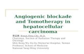 Angiogenic blockade and Tomotherapy in hepatocellular carcinoma