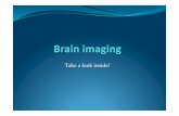 Brain imaging.pdf