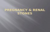 Pregnancy & renal stones