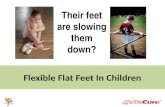 Flexible Flat Foot Treatment Options