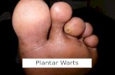 Plantar warts