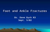 Foot ankle fractures