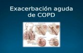 Exacerbación aguda COPD