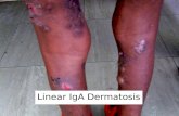 Linear IgA dermatosis