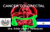 Cancer colorectal ok
