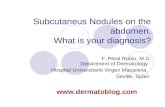 Subcutaneous nodules on the abdomen