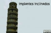 Implantes Inclinados