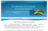 Tuberculosis Mamaria Alexander 2012