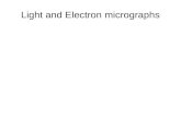 Electron and light micrographs