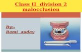 class ii division 2 malocclusion
