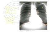 Aula 2   radiografia de tórax-2014-2
