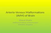 Arteriovenous Malformation (AVM) of Brain