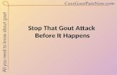 Stop that gout attack before it happens
