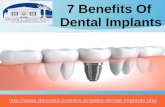 7 benefits of dental implants